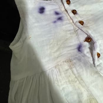 Yoğun Gıda Boyası Nedeniyle Kızım Zehirlendi, Firma Dönüş Yapmadı