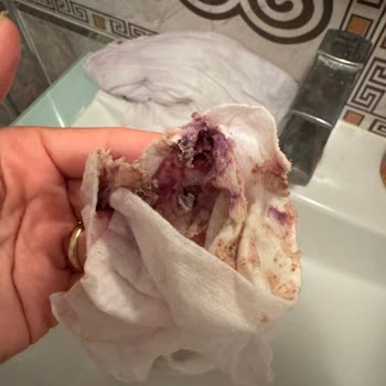 Yoğun Gıda Boyası Nedeniyle Kızım Zehirlendi, Firma Dönüş Yapmadı