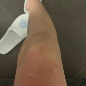 Karya Family Resort Özdere Şikayeti