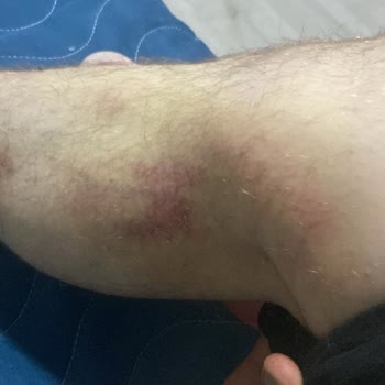 Arora Max Pro Direksiyon Arızasıyla Yaşadığım Büyük Tehlike