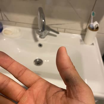 Şantiye Elektriğinde Süregelen Akım Dengesizliği Hayatımı Tehlikeye Atıyor