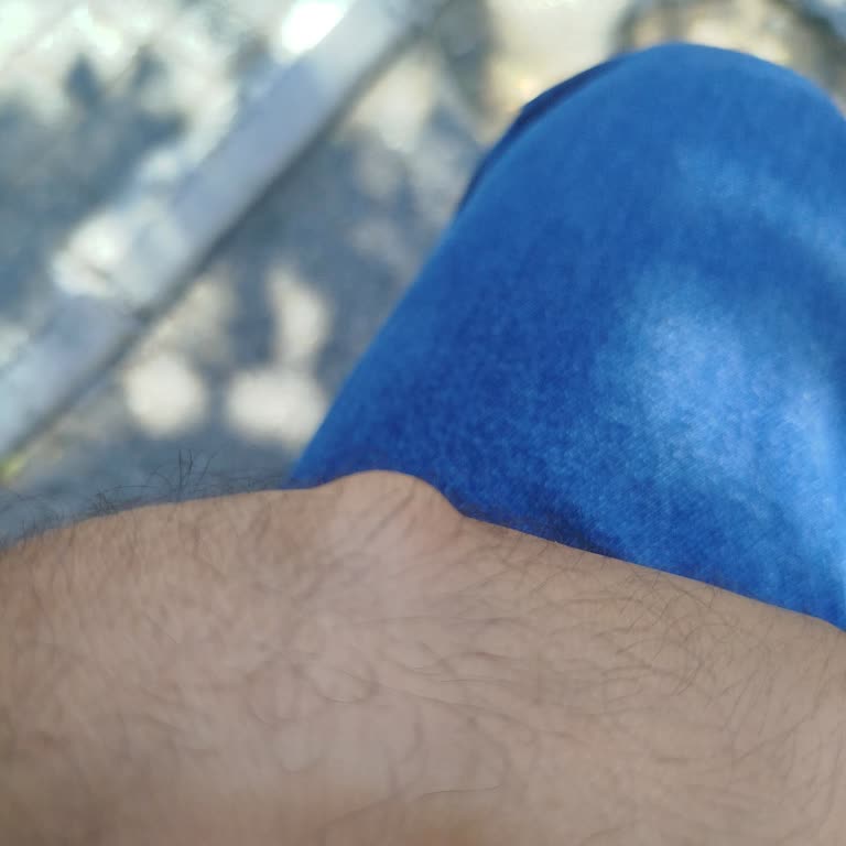 İzmir Katip Çelebi Hastanesi Elimdeki Ağrılı Kist İçin Çözüm Ve Tedavi Sürecinde Belirsizlik