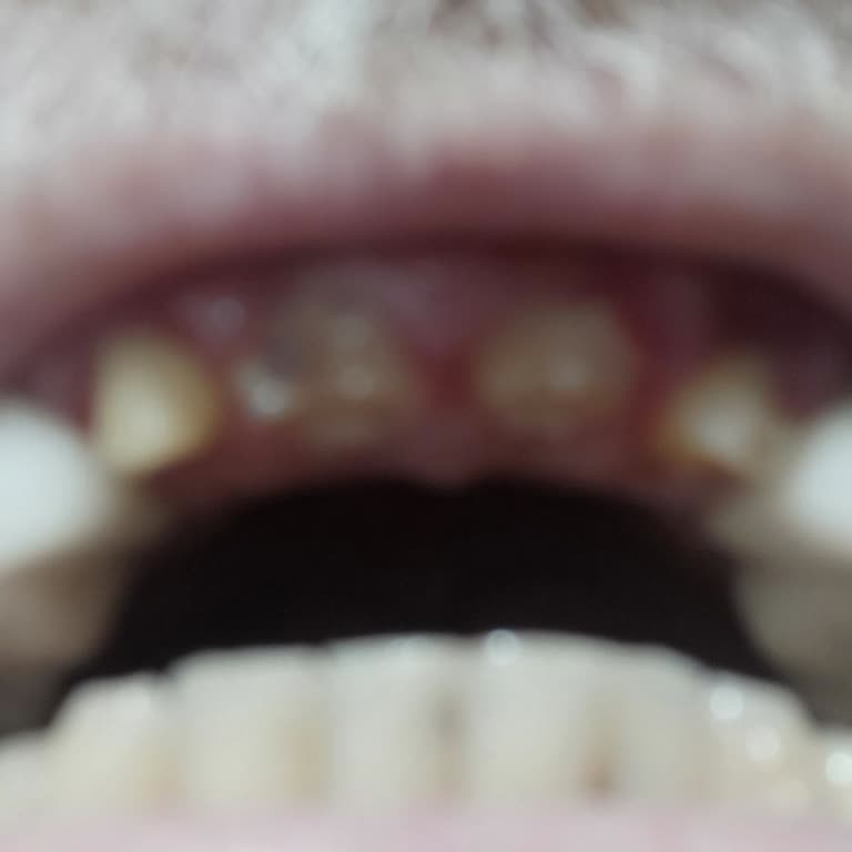 Dental İmplant Clinic A Plus Diş Kliniği / Silivri Şikayeti