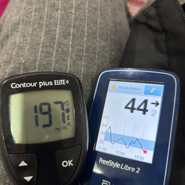 Libre 2 Sensörlerinde Sürekli Yanlış Ölçüm Ve Yetersiz Destek