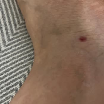 Guess Sandalet Kısa Sürede Ayağımı Yaraladı Mağaza Çözüm Sunmadı