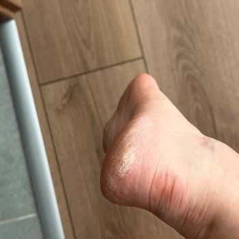 Guess Sandalet Kısa Sürede Ayağımı Yaraladı Mağaza Çözüm Sunmadı