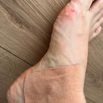 Guess Sandalet Kısa Sürede Ayağımı Yaraladı Mağaza Çözüm Sunmadı