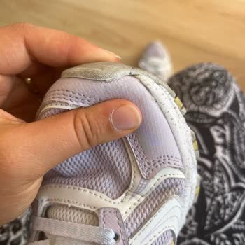 Kısa Sürede Açılan Skechers Ayakkabıya Çözüm Bekliyorum