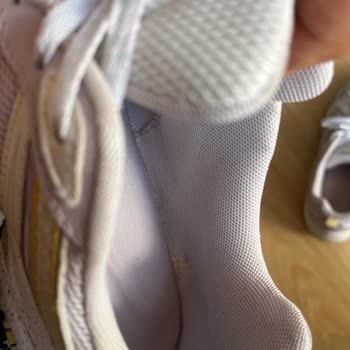 Kısa Sürede Açılan Skechers Ayakkabıya Çözüm Bekliyorum