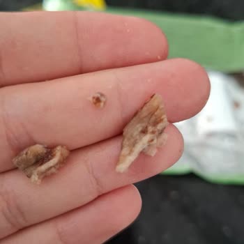 Gofretin İçinden Sert Parça Çıktı Dişimi Kırıyordum