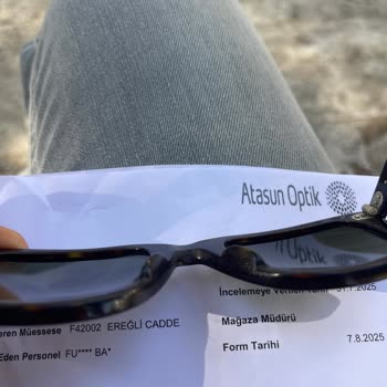 Rayban Gözlükte Pütürlenme Sorunu Ve Yetersiz Garanti Desteği
