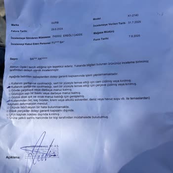 Rayban Gözlükte Pütürlenme Sorunu Ve Yetersiz Garanti Desteği