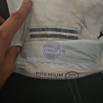 Bebek Bezinde Yabancı Cisim Şoku Ve Yetersiz Müşteri Hizmeti