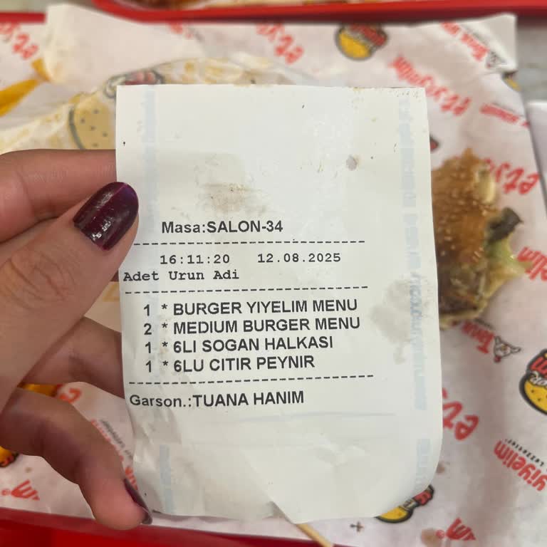 Burgerde Yabancı Madde Ve Hijyen Sorunu Nedeniyle Hayal Kırıklığı