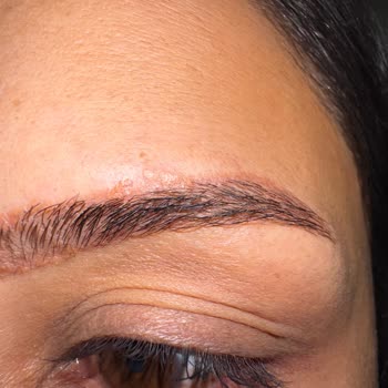 Kaş Pudralama İşlemi Sonrası Kalıcı Hasar Ve Yetersiz Bilgilendirme