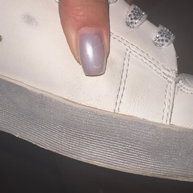 Kısa Sürede Derisi Çatlayan Golden Goose Ayakkabı İçin Ücret İadesi Talebim