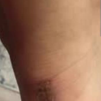 Kusurlu Ayakkabı Nedeniyle Yaşadığım Mağduriyet Ve İade Talebimin Reddi