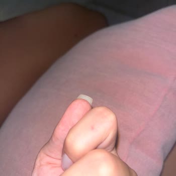 Jel Tırnak İşlemi Sonrası Acı Ve Memnuniyetsizlik Yaşadım