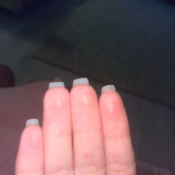 Jel Tırnak İşlemi Sonrası Acı Ve Memnuniyetsizlik Yaşadım
