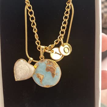 Alerji Yapan Kolye Sonrası Markadan Haftalardır Yanıt Alamıyorum