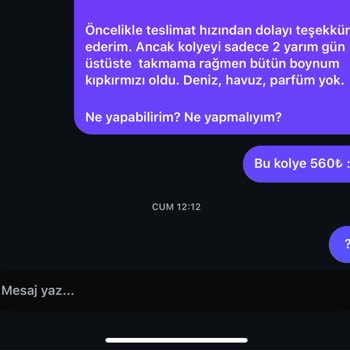 Alerji Yapan Kolye Sonrası Markadan Haftalardır Yanıt Alamıyorum