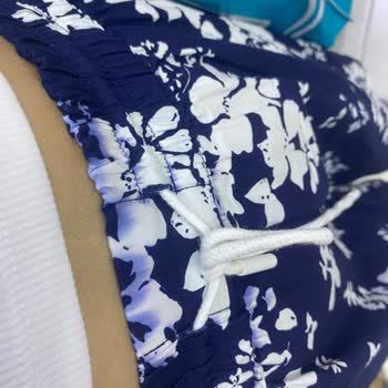 Kusurlu Şort İçin İade Talebim Reddedildi, Mağduriyet Yaşıyorum