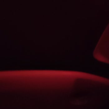 Hijyen Sorunu, Gecikme Ve Kötü Muameleyle Karşılaştık