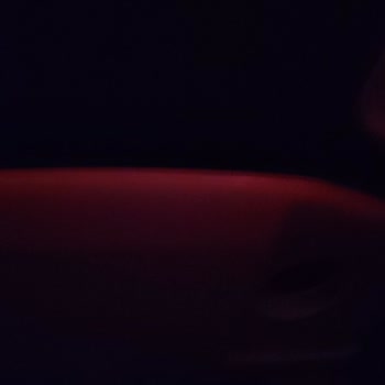 Hijyen Sorunu, Gecikme Ve Kötü Muameleyle Karşılaştık