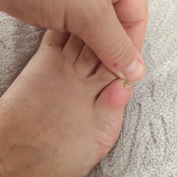 Lumberjack Terlikteki Zımba Metali Ayağımı Yaraladı, Kullanamıyorum!