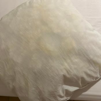 Kirli Daire, Eksik Havlu Ve İlgisiz Ev Sahibi Nedeniyle Paris'te Mağduriyet Yaşadım