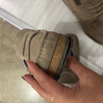Yurt Dışından Alınan Birkenstock Ayakkabıda Kısa Sürede Taban Açılması Ve Değişim Talebi