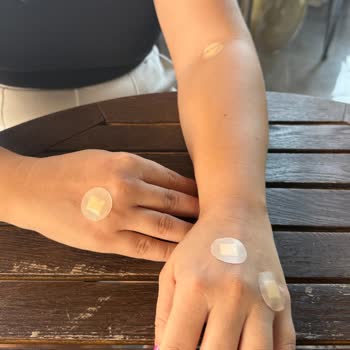 Memorial Hastanesi'nde Hemşirelerin Yetersizliği Nedeniyle Yaşanan Mağduriyet