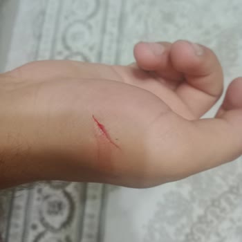 Bellona'dan Aldığım Ürünlerde Teslimat Ve Güvenlik Sorunları, Eksik Ve Hatalı Ürünler