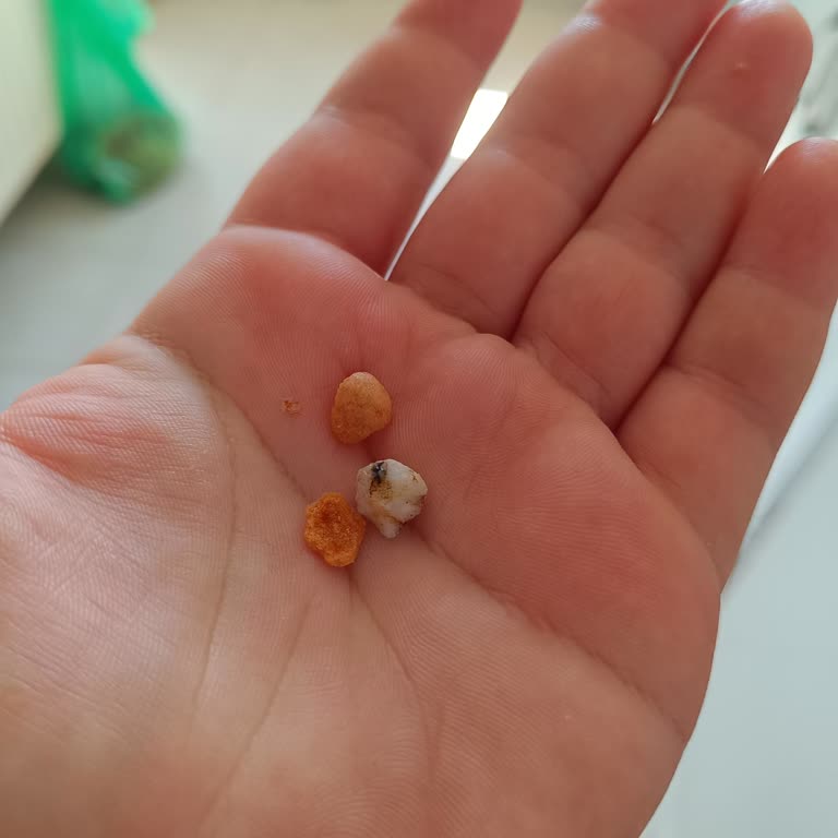 Leblebi Paketinden Taş Çıktı, Çocuğum Tehlike Atlattı