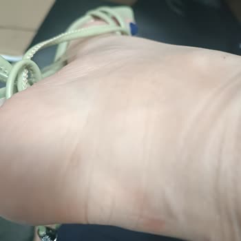 Desa’dan Alınan Ayakkabının Şeffaf Kısmı Sürekli Ayağımı Acıtıyor, Çözüm Sunulmadı