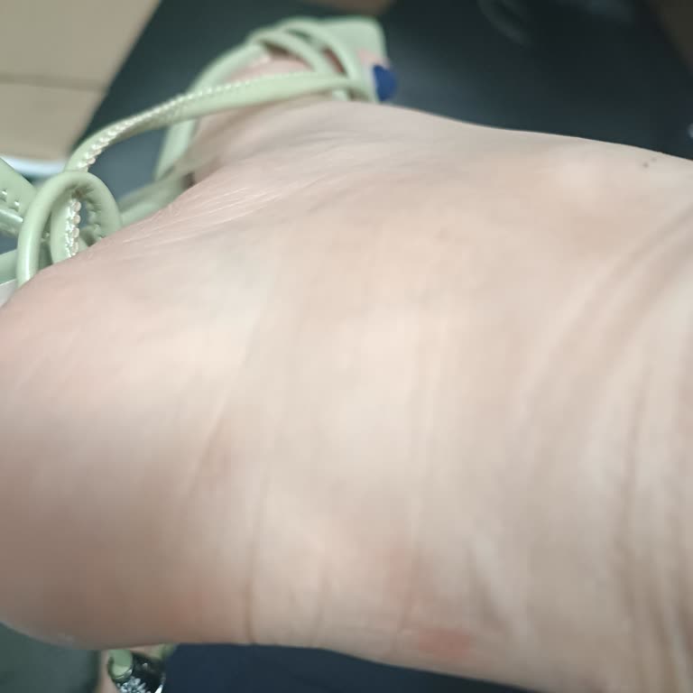 Desa’dan Alınan Ayakkabının Şeffaf Kısmı Sürekli Ayağımı Acıtıyor, Çözüm Sunulmadı