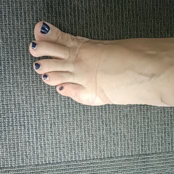 Desa’dan Alınan Ayakkabının Şeffaf Kısmı Sürekli Ayağımı Acıtıyor, Çözüm Sunulmadı