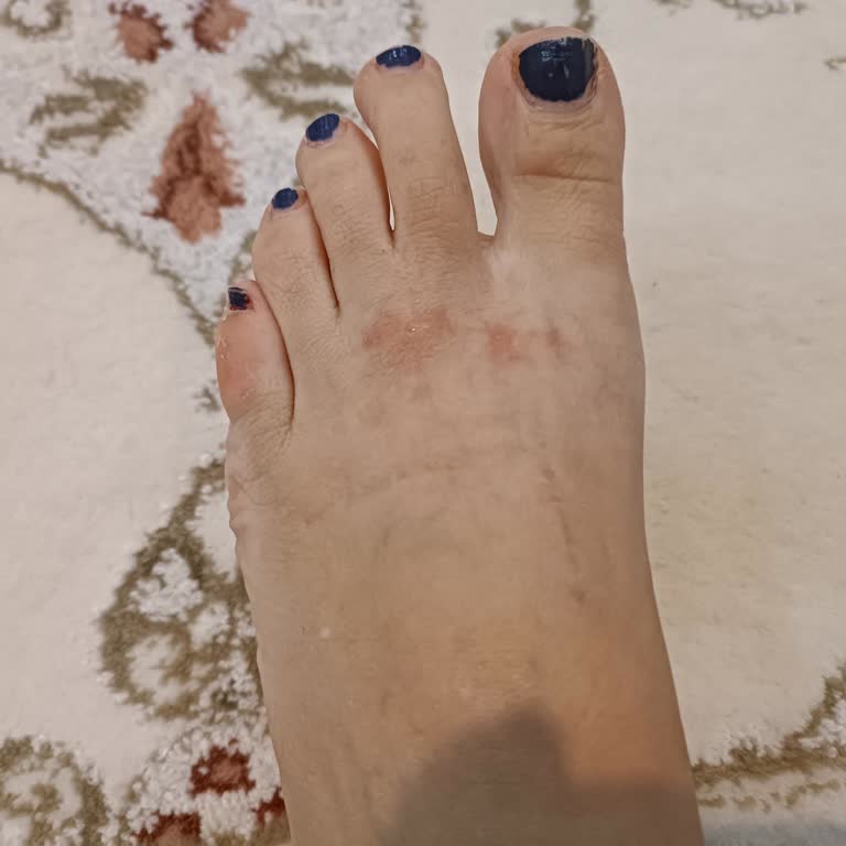 Desa’dan Alınan Ayakkabının Şeffaf Kısmı Sürekli Ayağımı Acıtıyor, Çözüm Sunulmadı