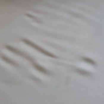 Yeni Aldığım Koltuk Takımında Sürekli Deformasyon Ve Yetersiz Servis Desteği