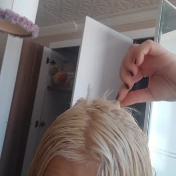 Kuaförde Saç Boyama Sonrası Ciddi Yanık Ve Mağduriyet Yaşadım