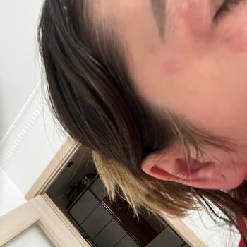 The Ordinary Ürünleri Yüzümde Alerji Ve Tahrişe Yol Açtı