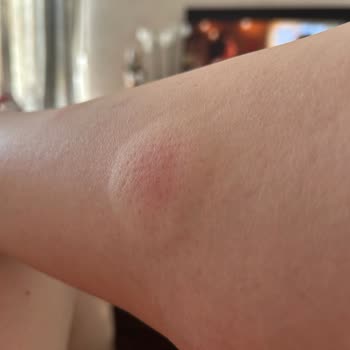 Kullandığım Takviye Ürünler Sağlık Sorunlarına Yol Açtı, Ücret İadesi Talep Ediyorum