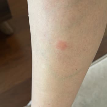 Kullandığım Takviye Ürünler Sağlık Sorunlarına Yol Açtı, Ücret İadesi Talep Ediyorum