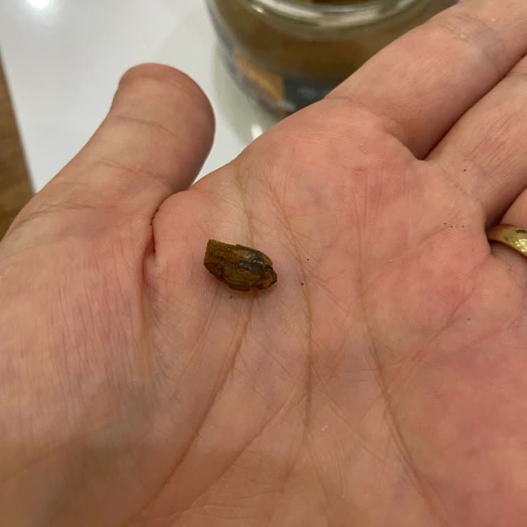 Kavanozdan Çıkan Cam Parçası Şok Etti