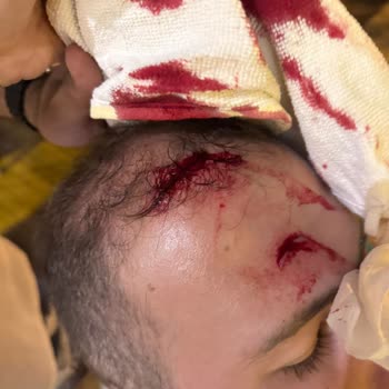 I Face Severe Head Injury and Refund Refusal at Airbnb Villa with Private Pool