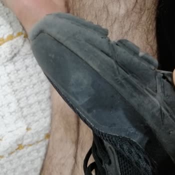 Skechers erkennt Schäden an selten getragenem Schuh nicht an