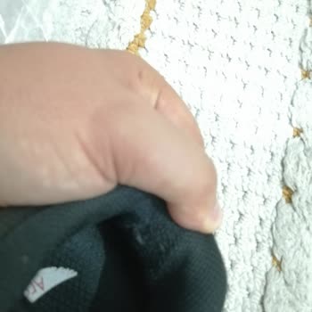 Skechers erkennt Schäden an selten getragenem Schuh nicht an