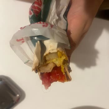 Çiğköfte Dürümden Saç Çıkması Ve Fiş Verilmemesi Hayal Kırıklığı Yarattı