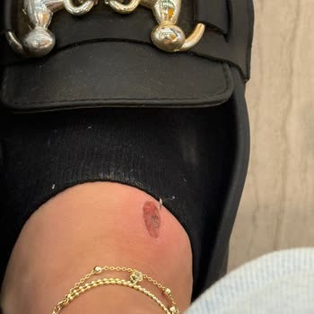 Bambi’den Aldığım Terlik Sağlığımı Tehlikeye Attı, İade Talebim Reddedildi!