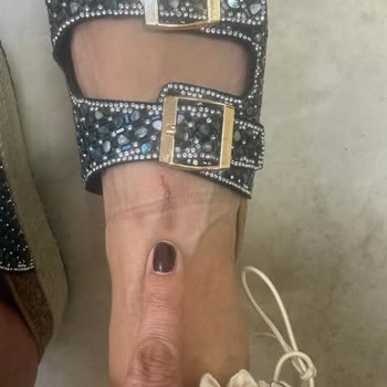 Bambi’den Aldığım Terlik Sağlığımı Tehlikeye Attı, İade Talebim Reddedildi!